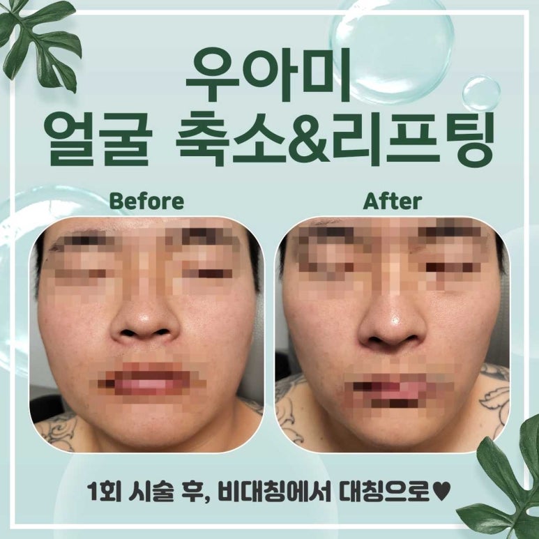 영주스킨케어 이미지