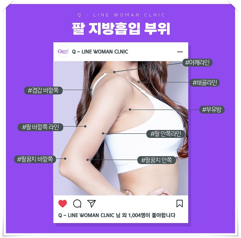 큐라인여성의원 이미지