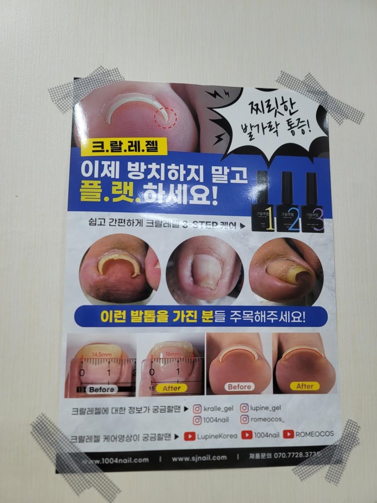 알미네일 이미지