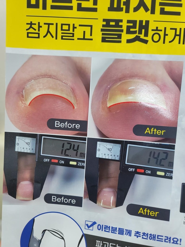 알미네일 이미지