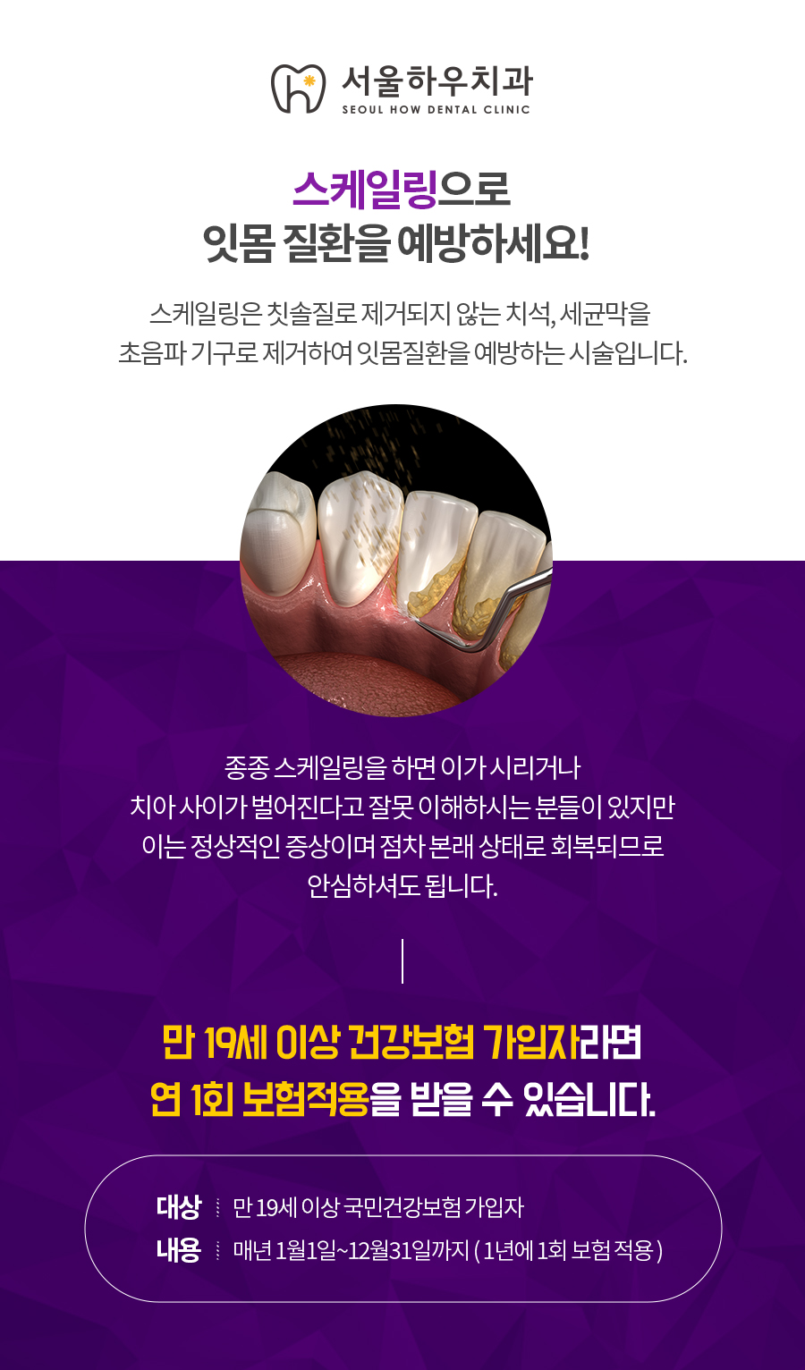 서울하우치과 이미지