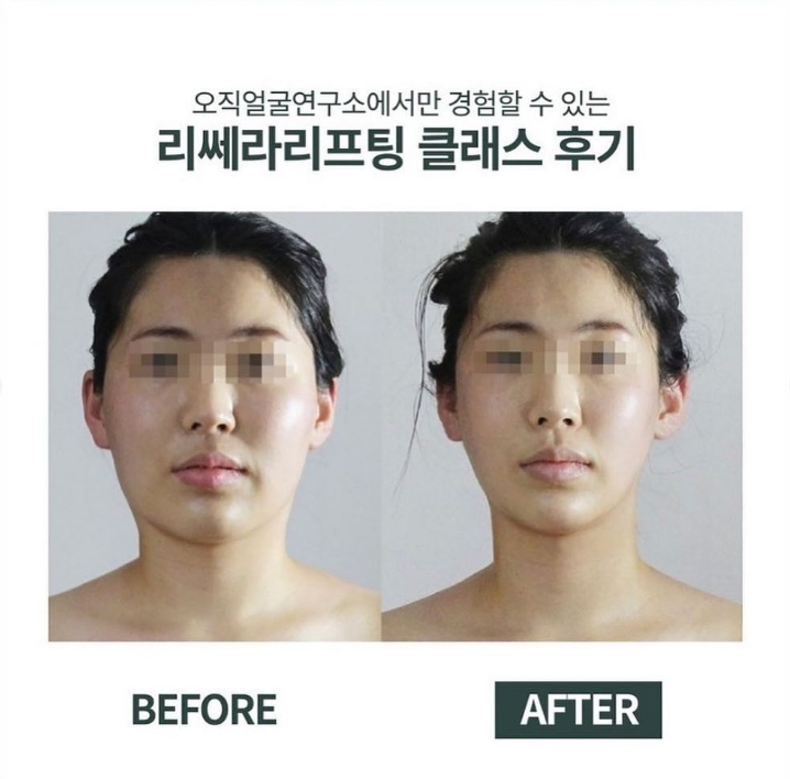 오직얼굴연구소 이미지