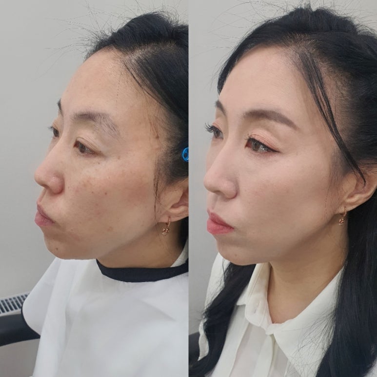 오블리속눈썹 이미지