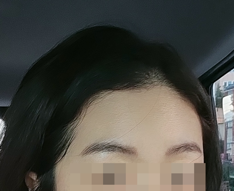 미가헤어라인 이미지