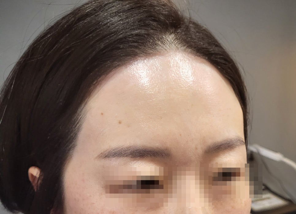 미가헤어라인 이미지