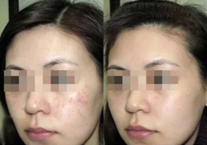 뷰티살롱아띠 이미지