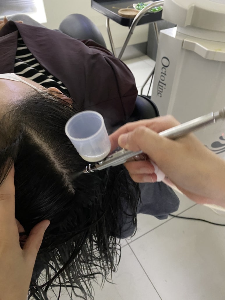 모바이오두피크리닉 이미지