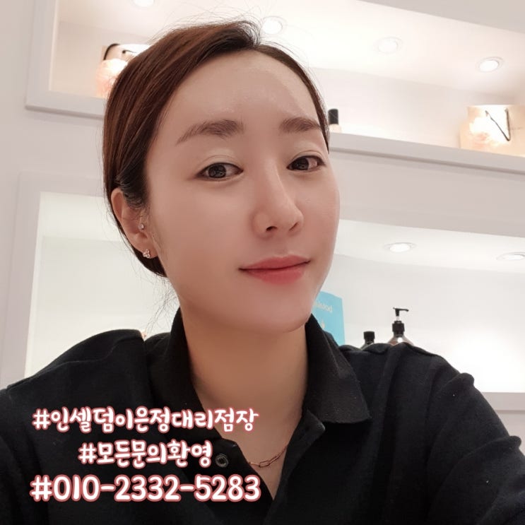 초이스 인셀덤 이미지