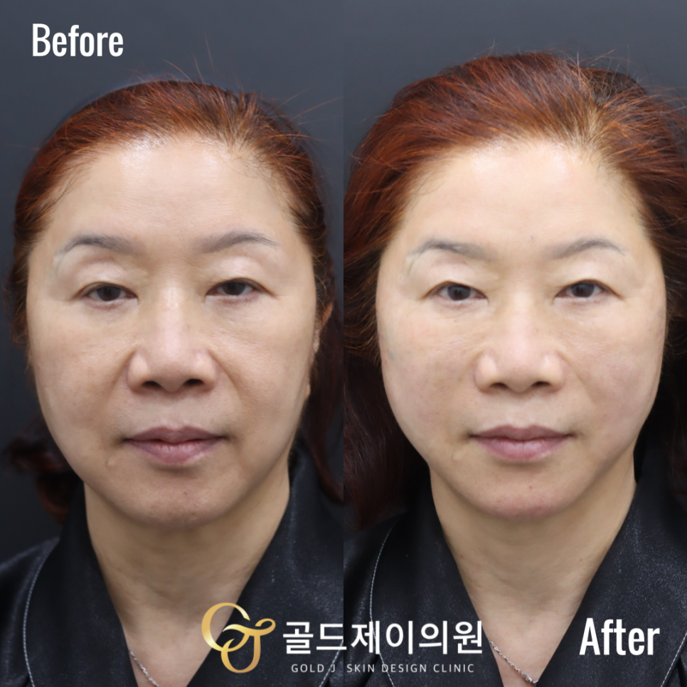 제이소프트 이미지