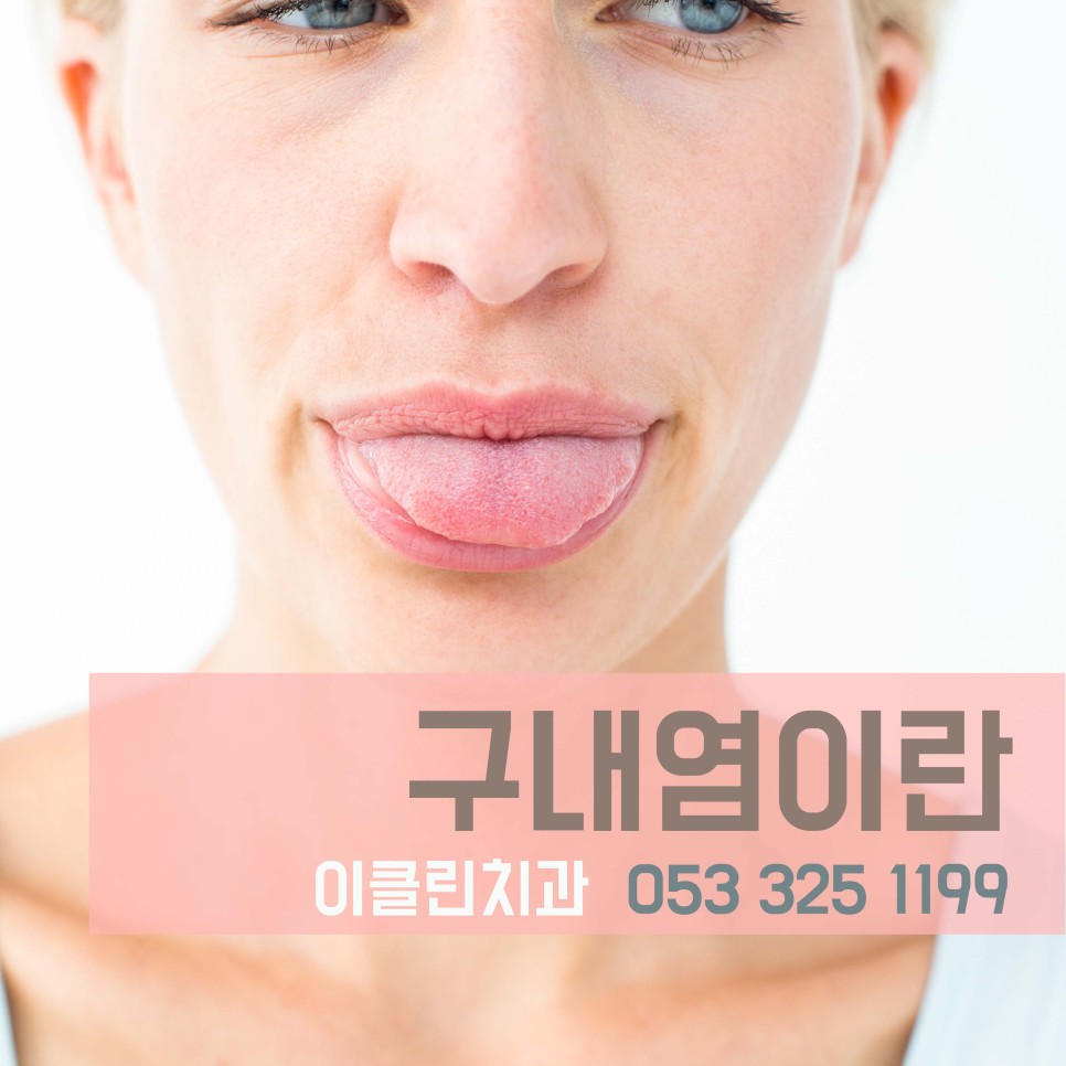 이제이클린 이미지