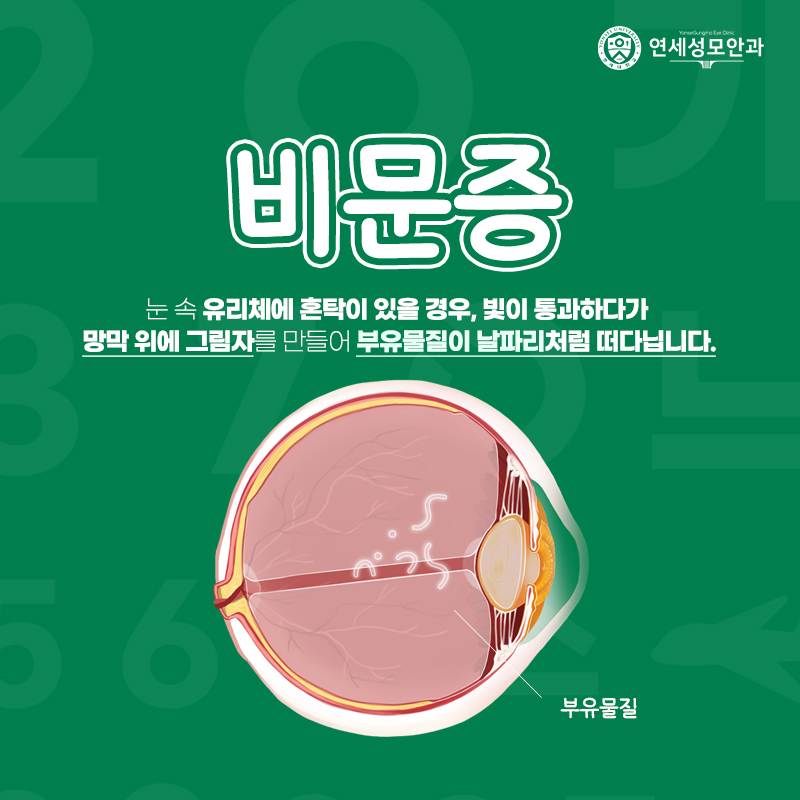 부천연세안과의원 이미지