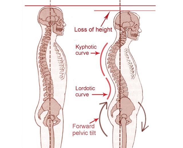 리메디PT 이미지