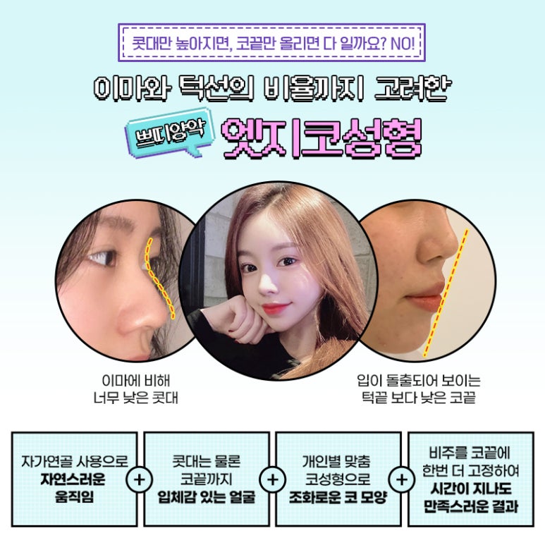 엣지성형외과 이미지