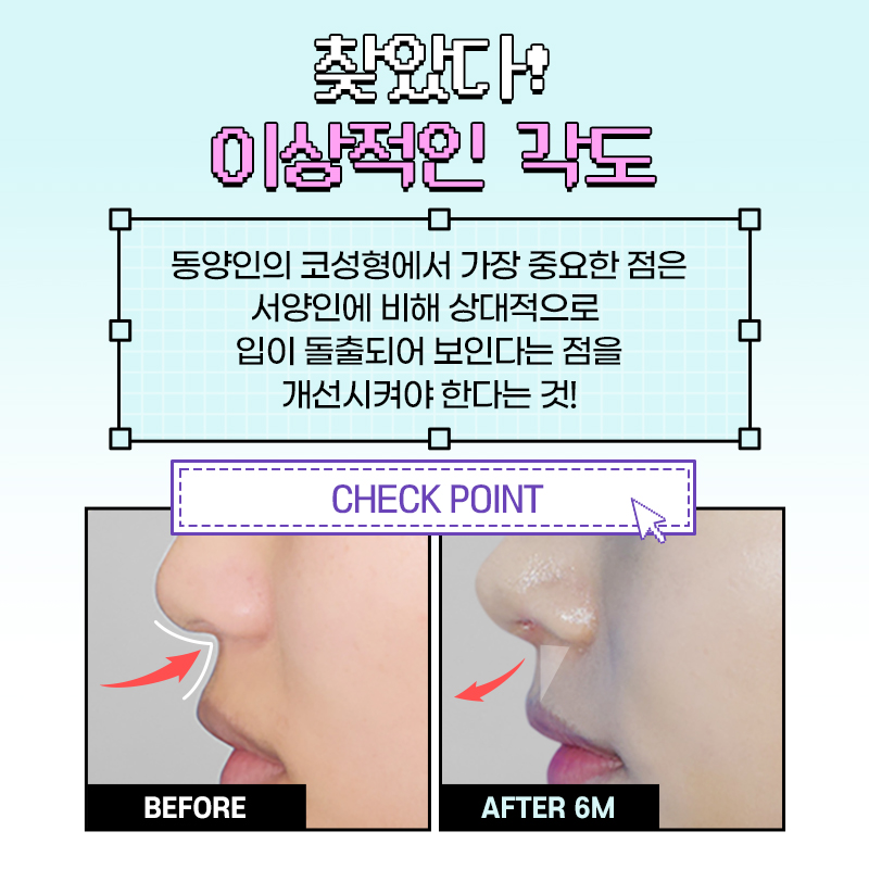 엣지성형외과 이미지