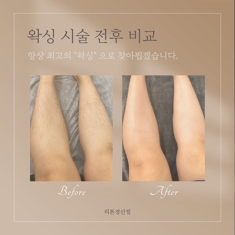 리본왁싱 경산점 이미지