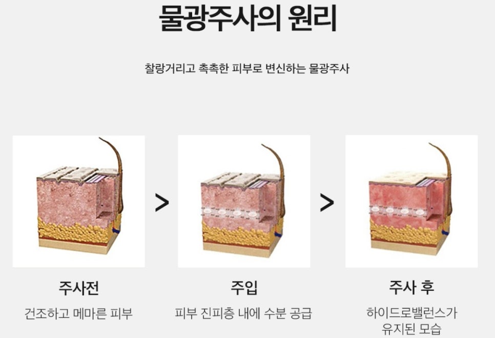 제스필클리닉 이미지