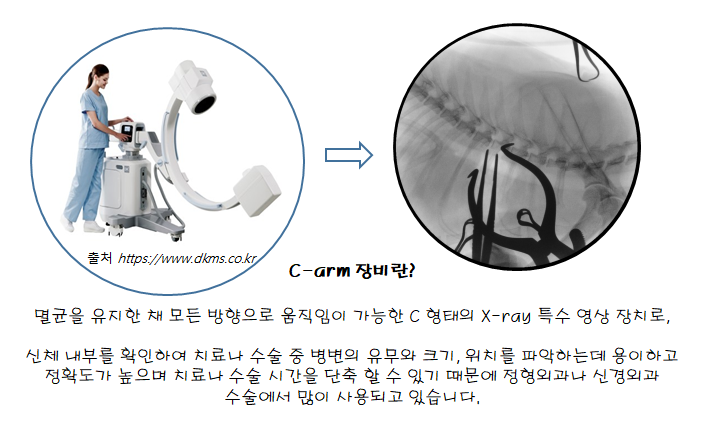 늑골집 이미지