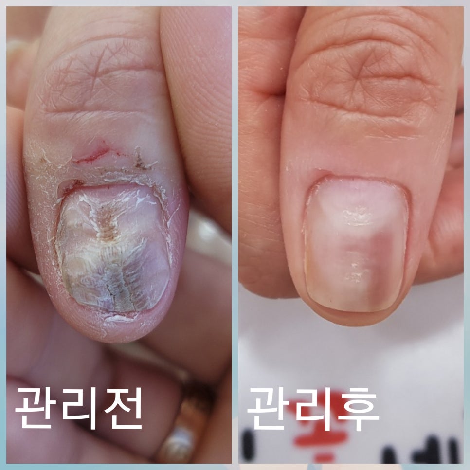 손에핀꽃 이미지