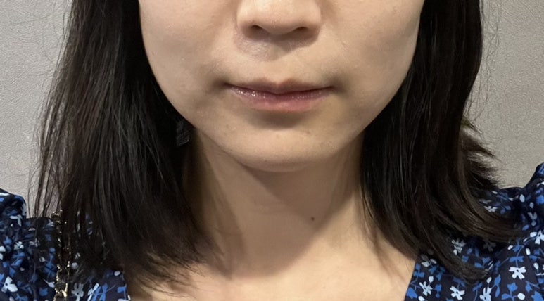 온에어성형외과의원 이미지
