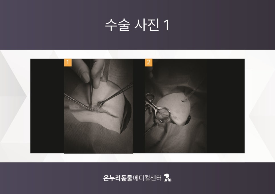늑골집 이미지