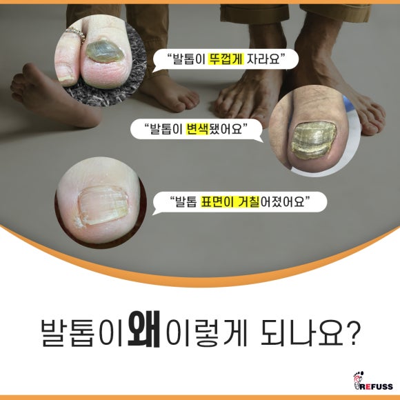 레푸스전주 이미지