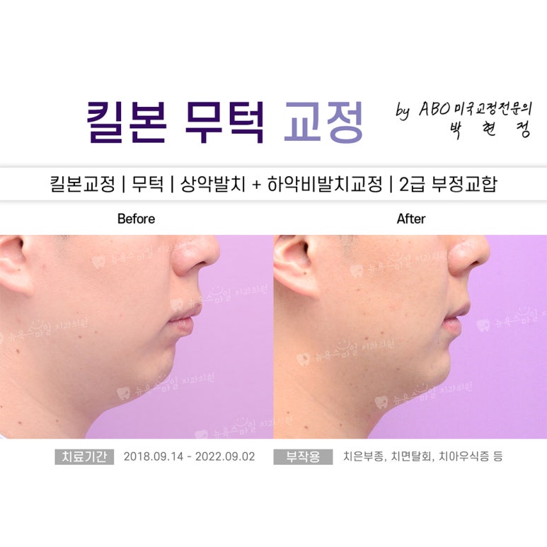 서면뉴욕치과의원 이미지