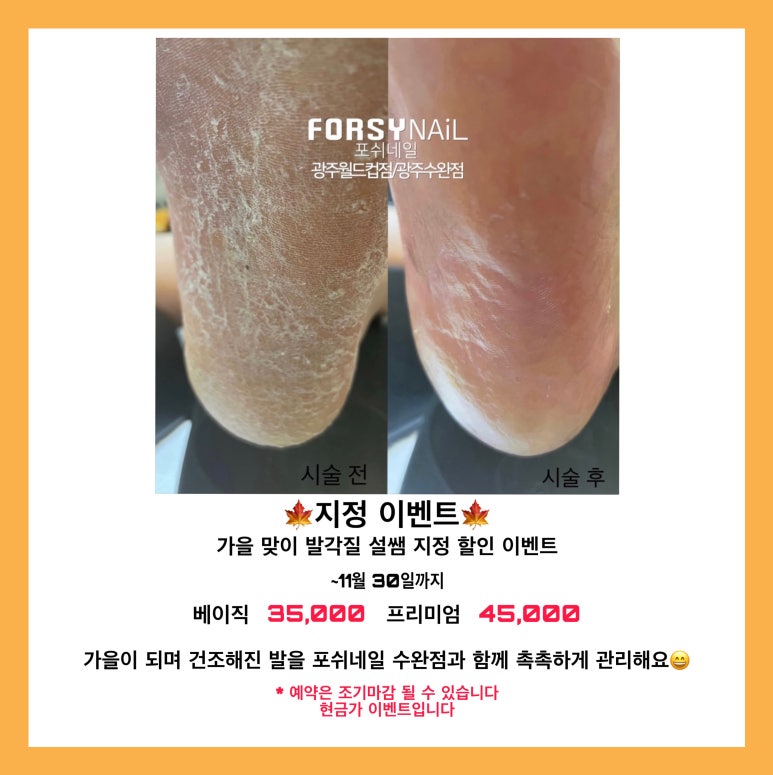 포쉬네일 이미지