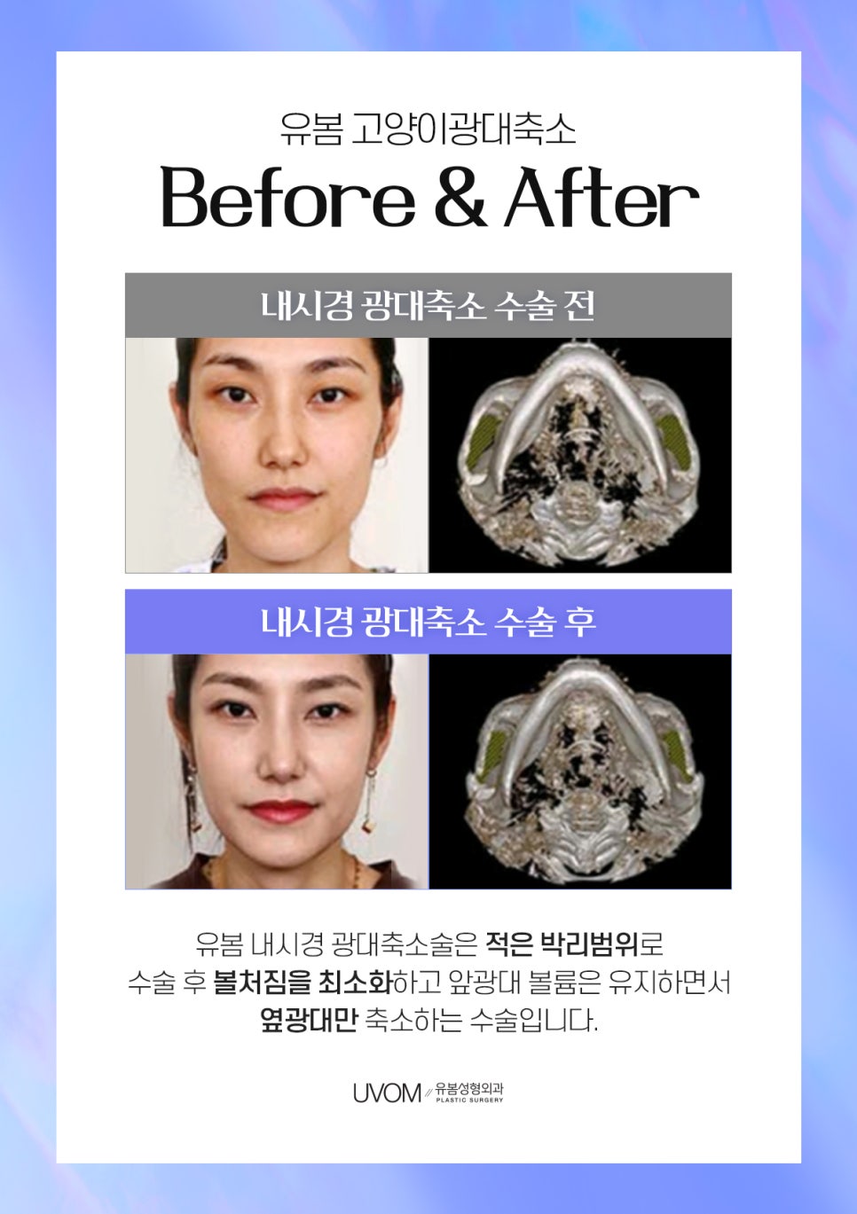 볼륨성형외과의원 이미지