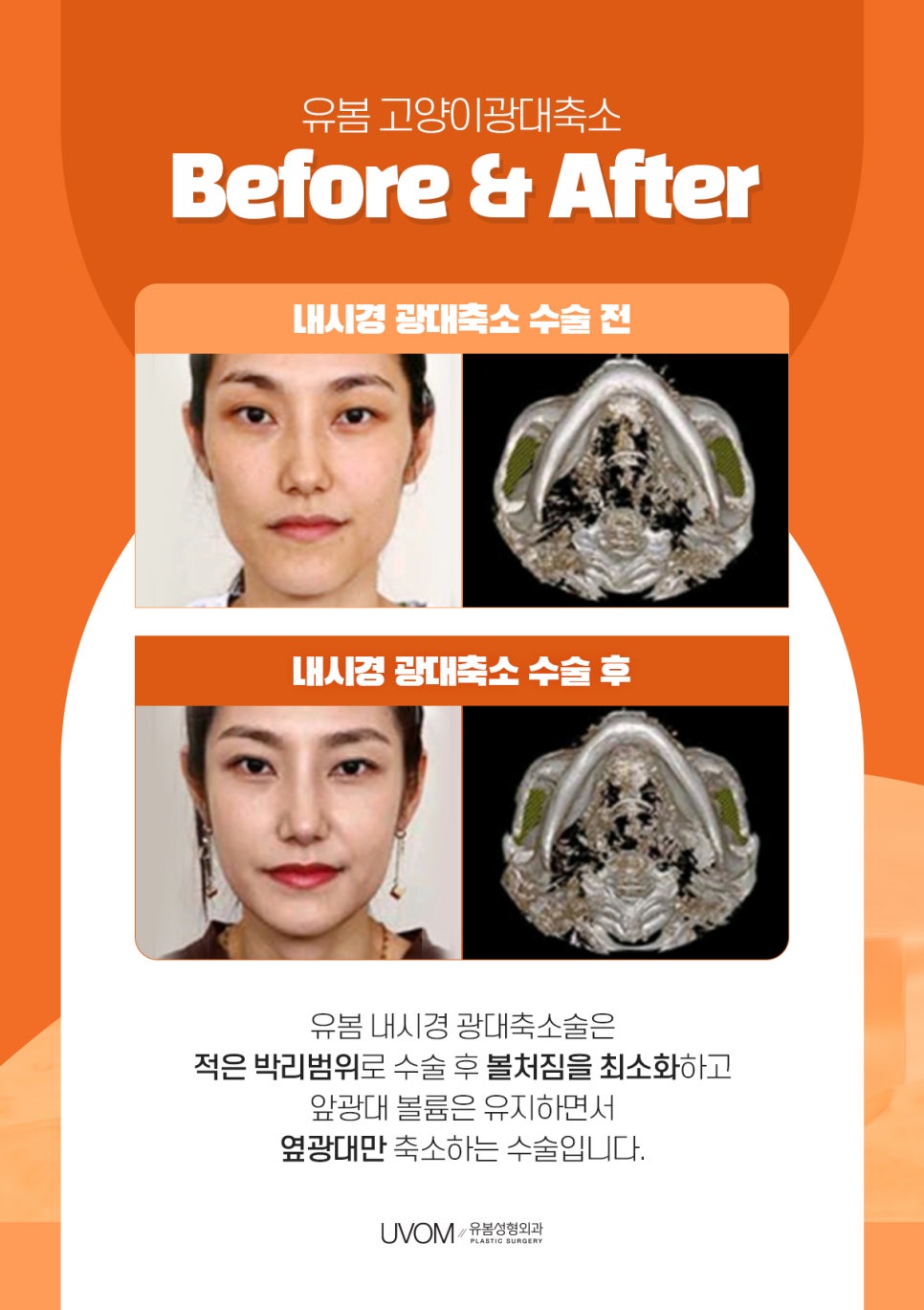 볼륨성형외과의원 이미지