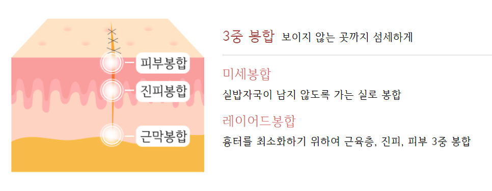 아이에스성형외과의원 이미지
