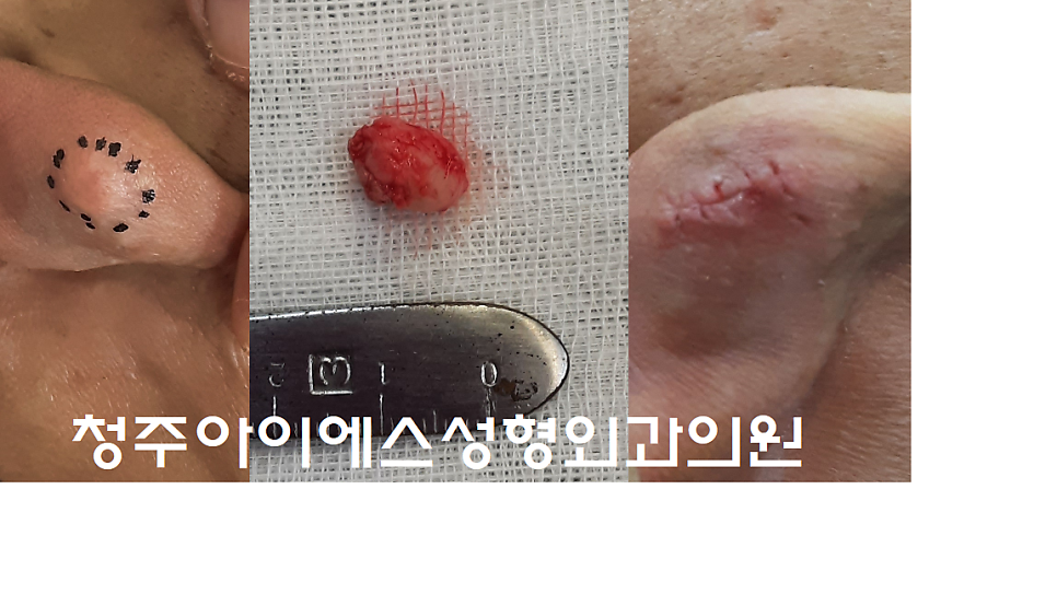 아이에스성형외과의원 이미지