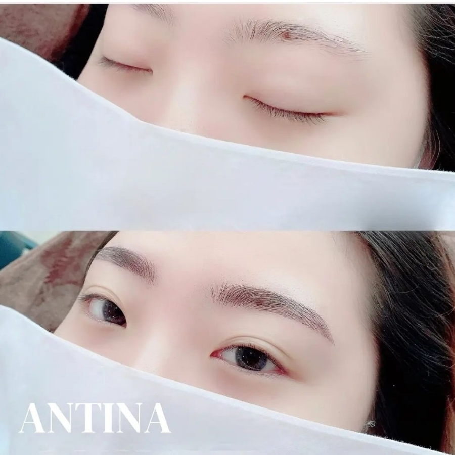 안티나브로우 이미지