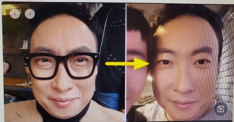 신비성형외과 이미지