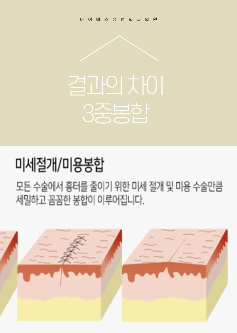 아이에스성형외과의원 이미지
