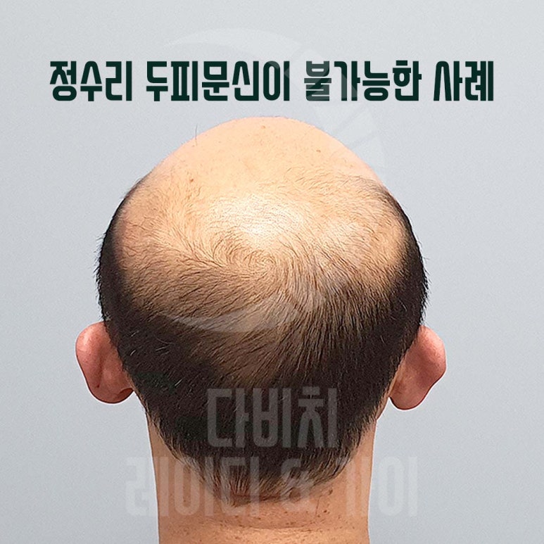 디에스엠피 이미지
