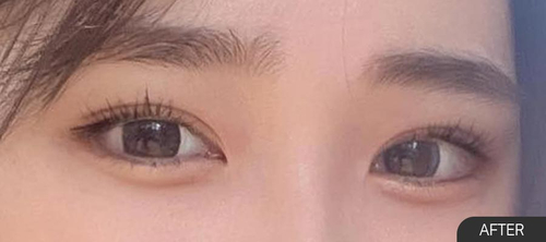 온에어성형외과의원 이미지