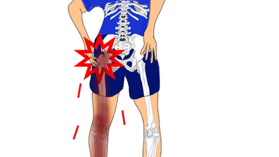 리메디PT 이미지