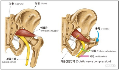 리메디PT 이미지