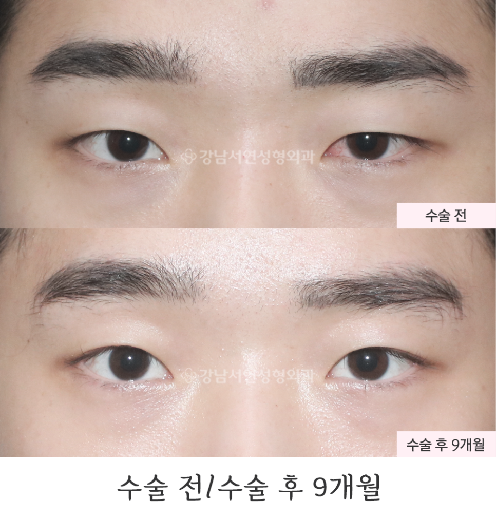 서연성형외과의원 이미지