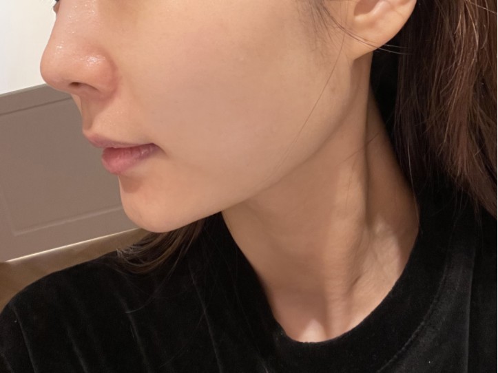 라인에스테 이미지