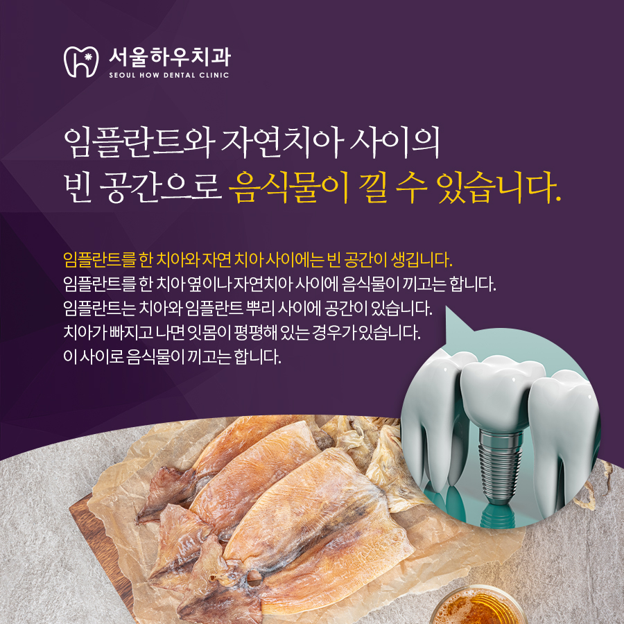 서울하우치과 이미지