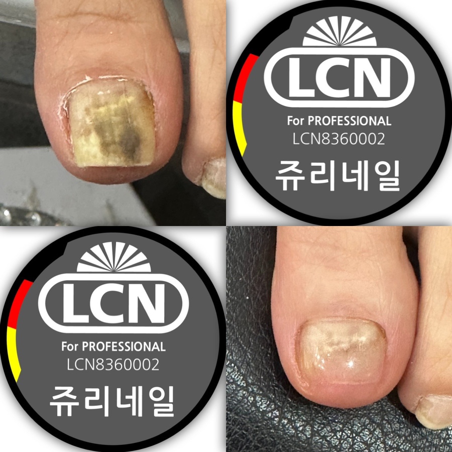 쥬리네일 이미지