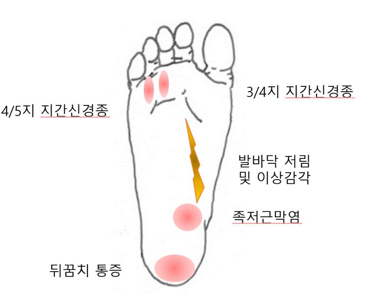 돈이요족발 이미지