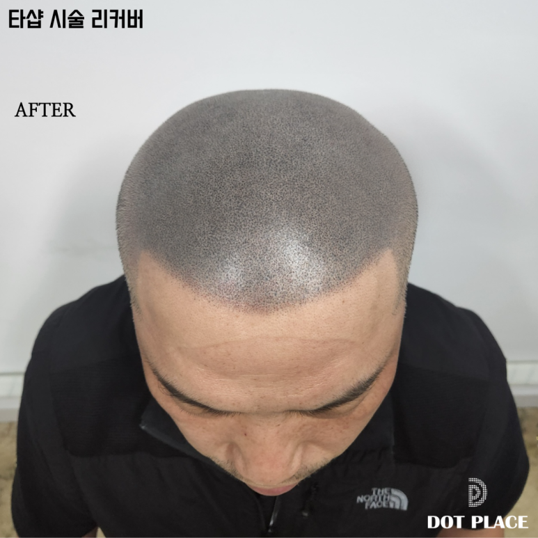 닷플레이스 이미지