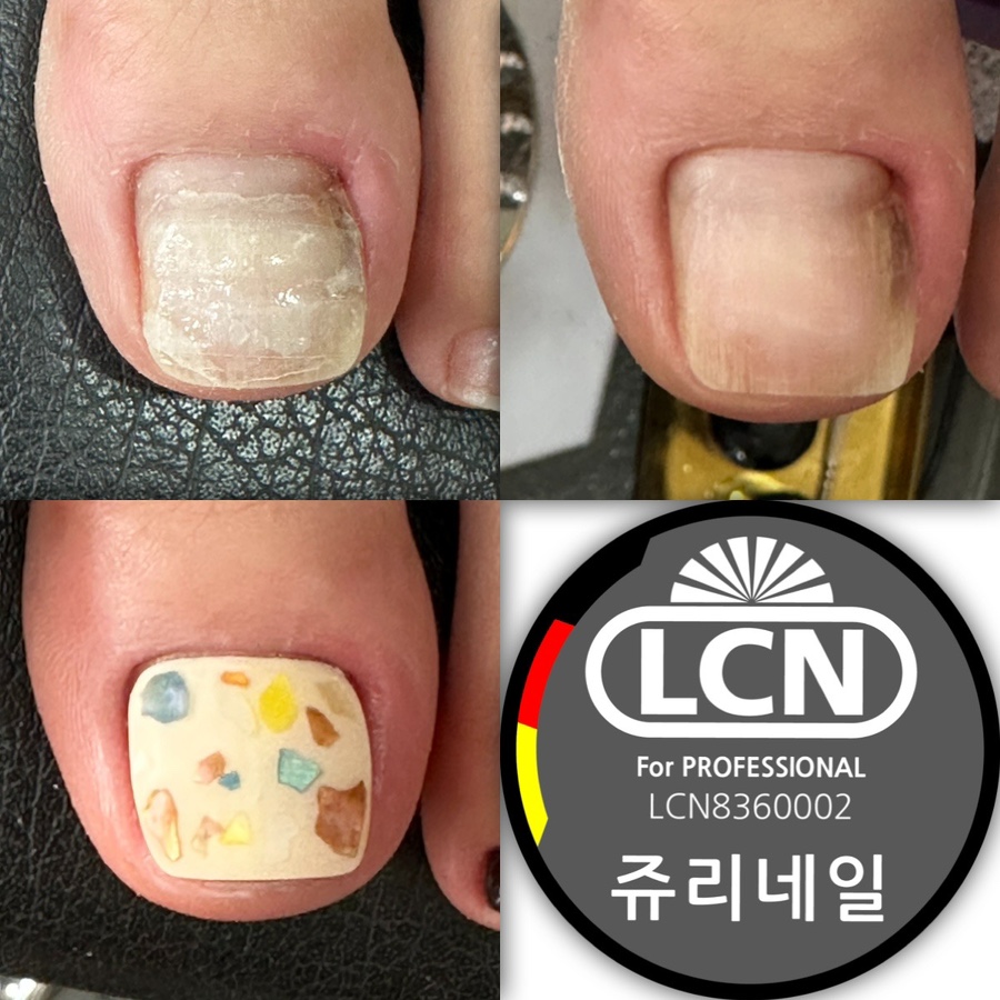 쥬리네일 이미지