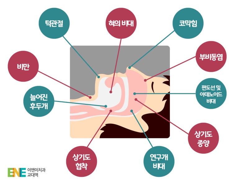이엔이 이미지