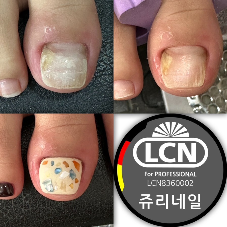 쥬리네일 이미지