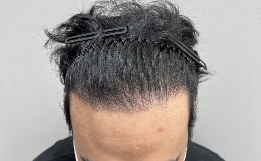 픽스칼프 이미지