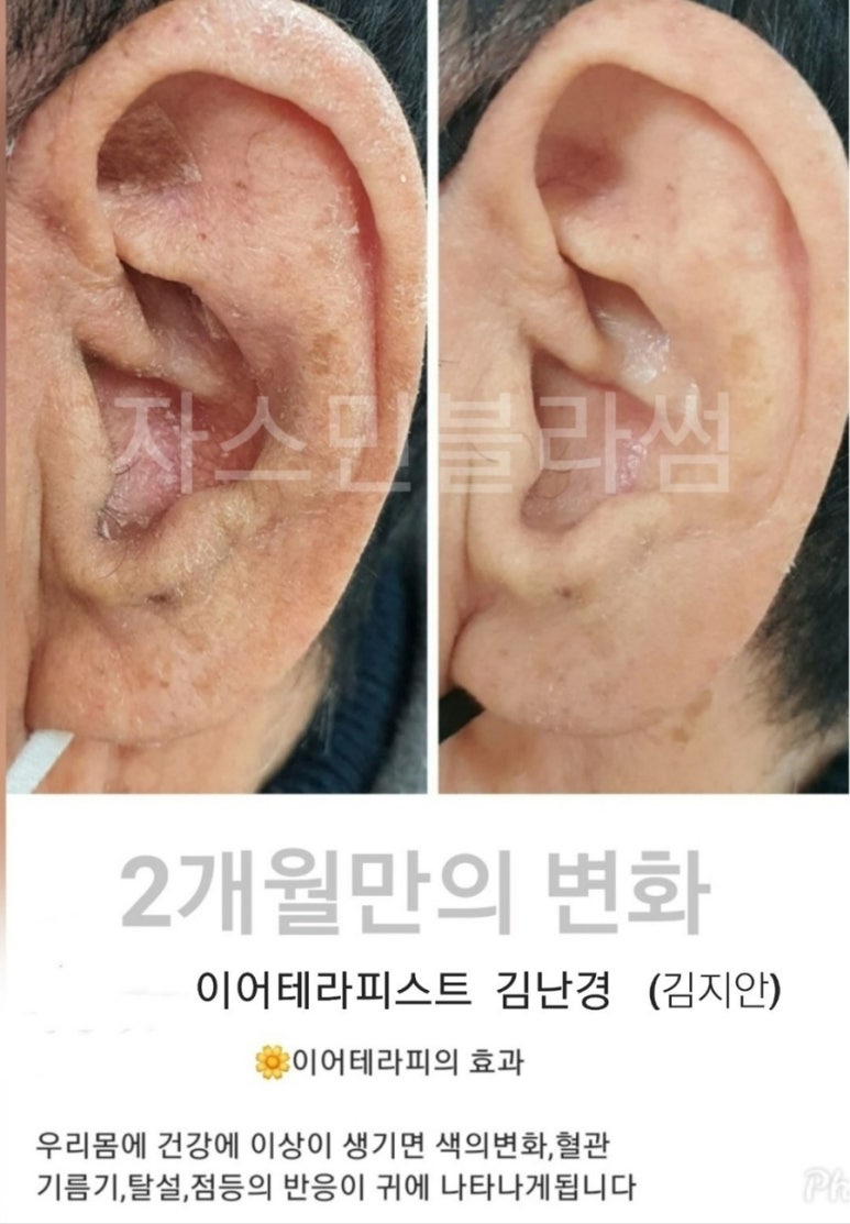 쟈스민테라피 이미지