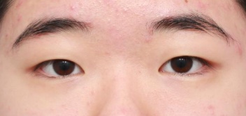 라이블리성형외과의원 이미지